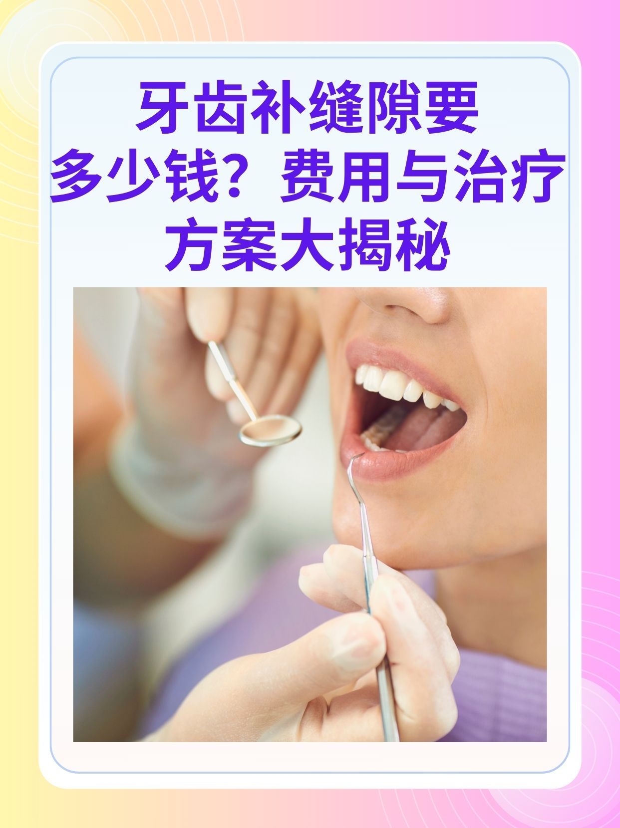 蚌埠补牙医保可以报销吗(补牙医保可以报销吗 哪些可以报销呢)